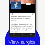 تحميل تطبيق Touch Surgery